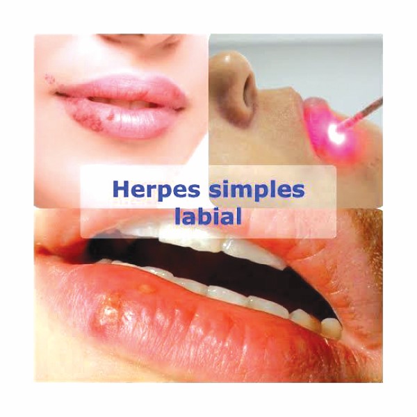 Tratamento com laser para quem sofre com doenças bucais