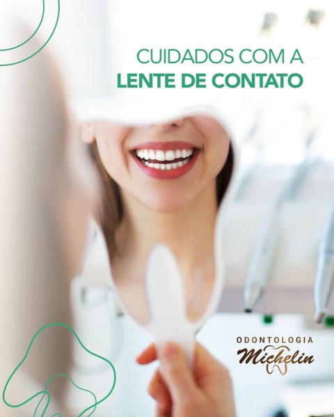 Odontologia Michelin dá dicas de como cuidar das lentes de contato dental