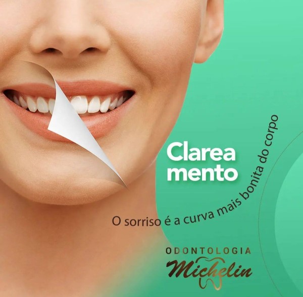 Odontologia Michelin oferece serviço de clareamento dental