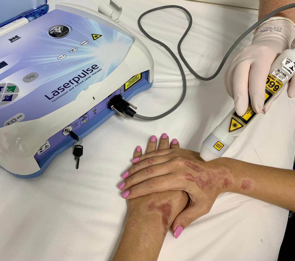 UniAvan oferece tratamento gratuito para lesões na pele 